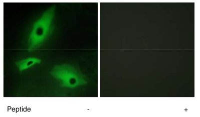 Immunocytochemistry/ Immunofluorescence - Anti-LTBR antibody (AB70063)