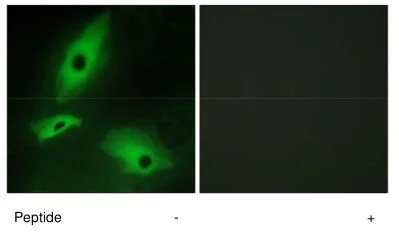 Immunocytochemistry/ Immunofluorescence - Anti-LTBR antibody (AB70063)