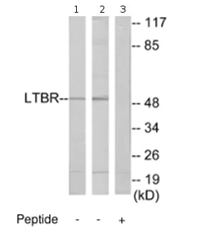 Western blot - Anti-LTBR antibody (AB70063)