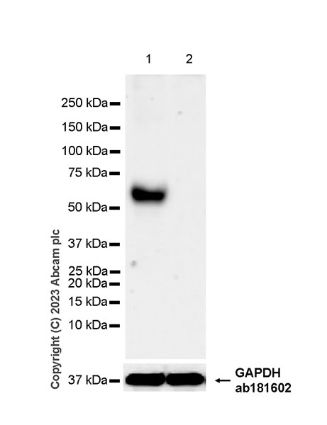 Western blot - Anti-LTBR antibody [EPR26096-171] (AB313561), expandable thumbnail