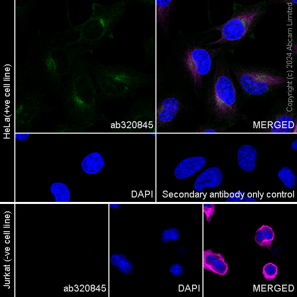 Immunocytochemistry/ Immunofluorescence - Anti-LTBR antibody [RM2069] (AB320845), expandable thumbnail