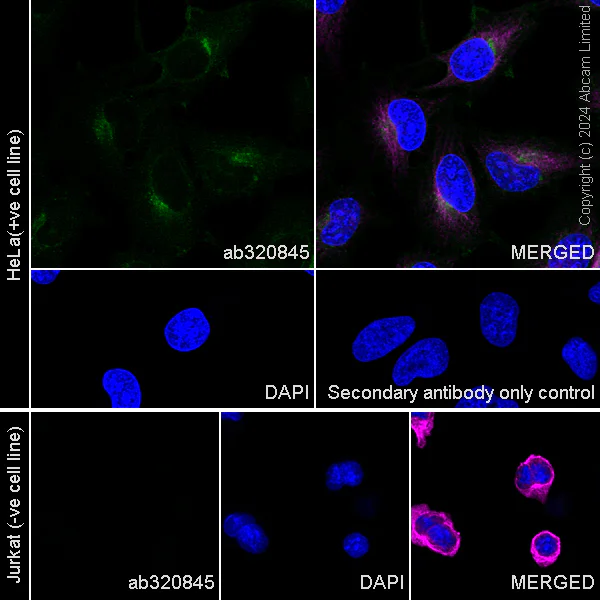 Immunocytochemistry/ Immunofluorescence - Anti-LTBR antibody [RM2069] - BSA and Azide free (AB320846)
