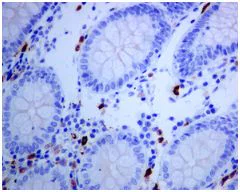 Immunohistochemistry (Formalin/PFA-fixed paraffin-embedded sections) - Anti-LTK antibody [EPR5175(2)] (AB129155)