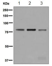 Western blot - Anti-LTK antibody [EPR5175(2)] (AB129155)