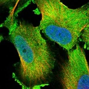 Immunocytochemistry/ Immunofluorescence - Anti-LTV1 antibody (AB122100)