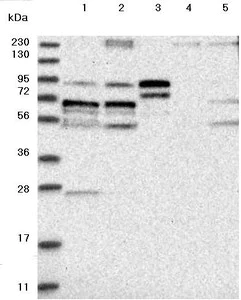 Western blot - Anti-LTV1 antibody (AB122100)