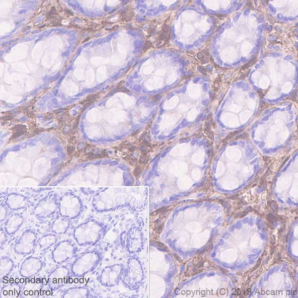 Immunohistochemistry (Formalin/PFA-fixed paraffin-embedded sections) - Anti-Lumican antibody [EPR22510-47] (AB252924), expandable thumbnail