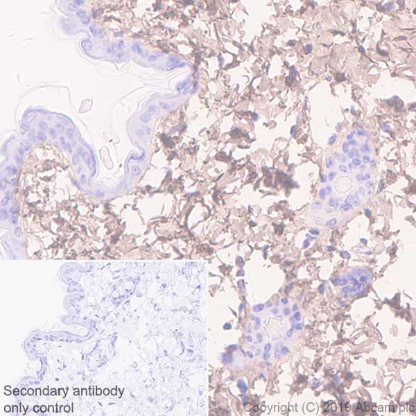 Immunohistochemistry (Formalin/PFA-fixed paraffin-embedded sections) - Anti-Lumican antibody [EPR22510-47] (AB252924), expandable thumbnail