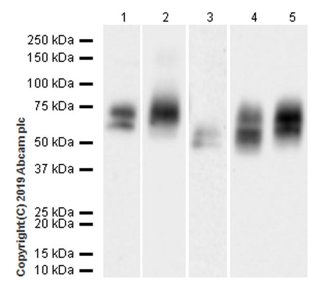 Western blot - Anti-Lumican antibody [EPR22510-47] (AB252924), expandable thumbnail