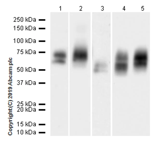 Western blot - Anti-Lumican antibody [EPR22510-47] (AB252924)