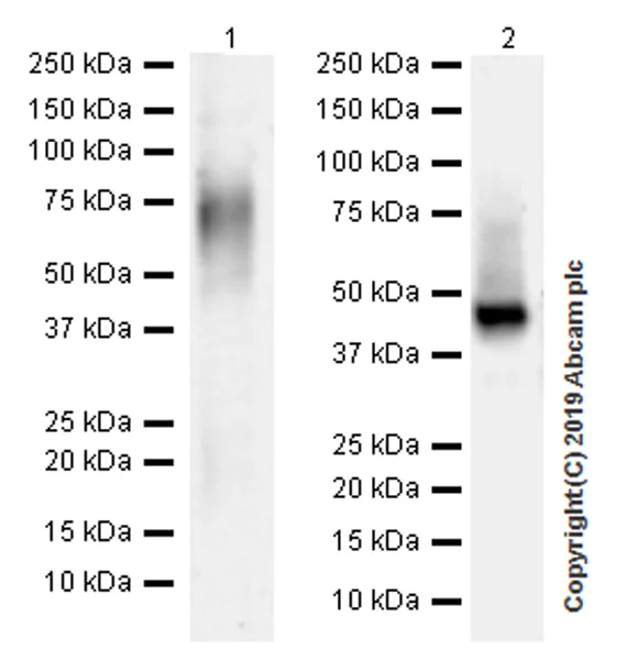 Western blot - Anti-Lumican antibody [EPR22510-47] (AB252924)