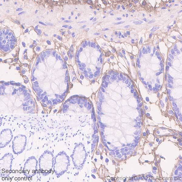 Immunohistochemistry (Formalin/PFA-fixed paraffin-embedded sections) - Anti-Lumican antibody [EPR22510-47] - BSA and Azide free (AB255279)