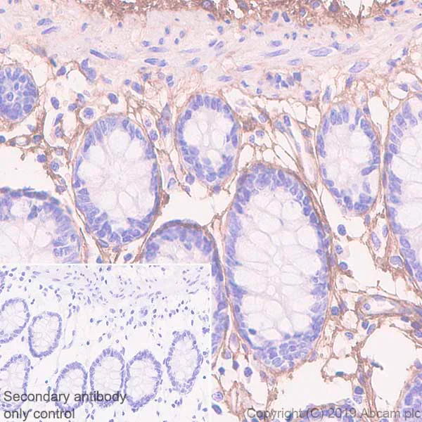 Immunohistochemistry (Formalin/PFA-fixed paraffin-embedded sections) - Anti-Lumican antibody [EPR22510-47] - BSA and Azide free (AB255279)
