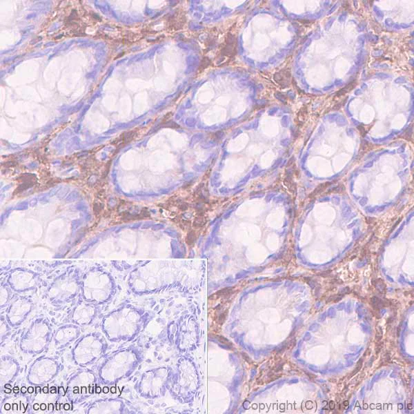 Immunohistochemistry (Formalin/PFA-fixed paraffin-embedded sections) - Anti-Lumican antibody [EPR22510-47] - BSA and Azide free (AB255279)