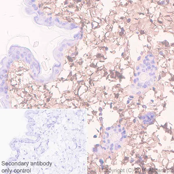 Immunohistochemistry (Formalin/PFA-fixed paraffin-embedded sections) - Anti-Lumican antibody [EPR22510-47] - BSA and Azide free (AB255279)