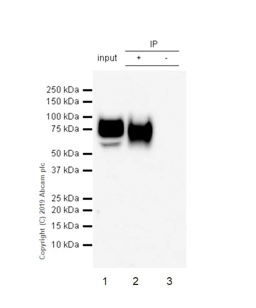 Immunoprecipitation - Anti-Lumican antibody [EPR22511-63] (AB252925)
