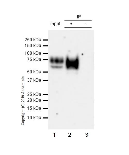 Immunoprecipitation - Anti-Lumican antibody [EPR22511-63] (AB252925)