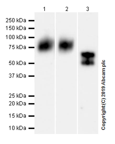 Western blot - Anti-Lumican antibody [EPR22511-63] (AB252925)