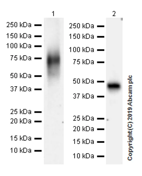 Western blot - Anti-Lumican antibody [EPR22511-63] (AB252925)