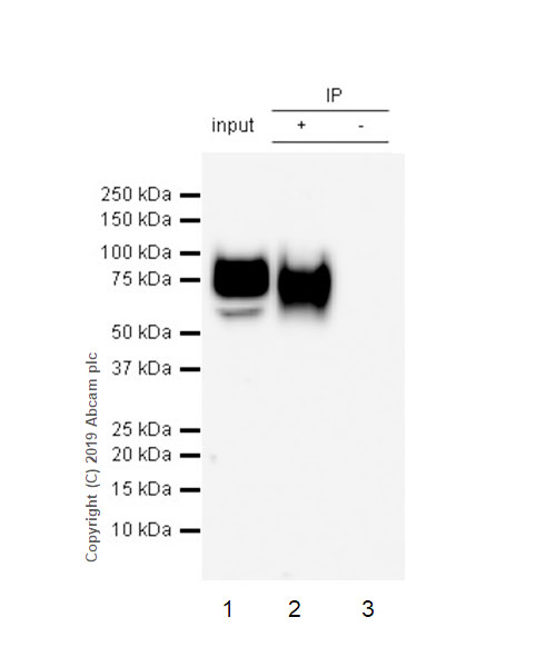 Immunoprecipitation - Anti-Lumican antibody [EPR22511-63] - BSA and Azide free (AB254995)