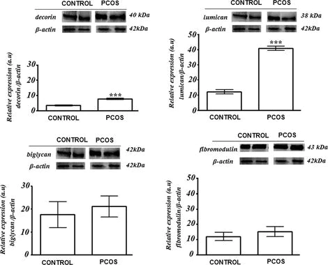 Western blot - Anti-Lumican antibody [EPR8898(2)] (AB168348)