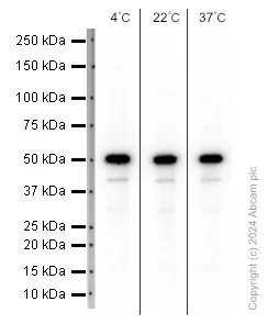 Western blot - Anti-Lumican antibody [EPR8898(2)] (AB168348)