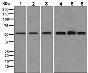 Western blot - Anti-Lumican antibody [EPR8898(2)] (AB168348)