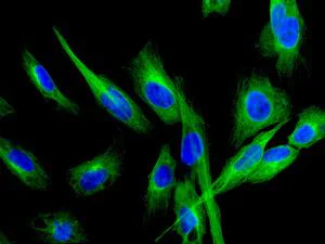 Immunocytochemistry/ Immunofluorescence - Anti-Lumican antibody [EPR8898(2)] - BSA and Azide free (AB198974)