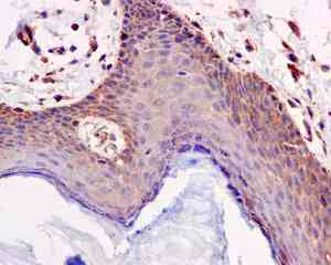 Immunohistochemistry (Formalin/PFA-fixed paraffin-embedded sections) - Anti-Lumican antibody [EPR8898(2)] - BSA and Azide free (AB198974)
