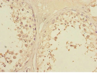 Immunohistochemistry (Formalin/PFA-fixed paraffin-embedded sections) - Anti-Lunatic Fringe antibody (AB235534)