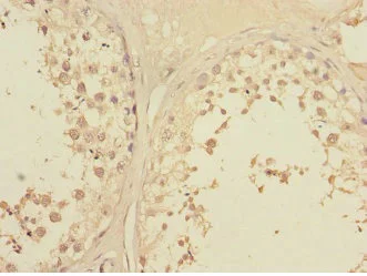 Immunohistochemistry (Formalin/PFA-fixed paraffin-embedded sections) - Anti-Lunatic Fringe antibody (AB235534)