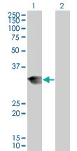 Western blot - Lunatic Fringe overexpression 293T lysate (whole cell) (AB94182)