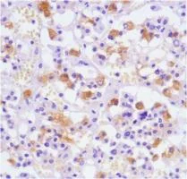Immunohistochemistry (Formalin/PFA-fixed paraffin-embedded sections) - Anti-Luteinizing Hormone antibody [SP132] - BSA and Azide free (AB236228)