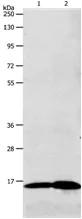 Western blot - Anti-Luteinizing Hormone beta antibody (AB183154)