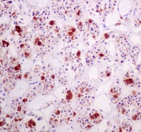 Immunohistochemistry (Formalin/PFA-fixed paraffin-embedded sections) - Anti-Luteinizing Hormone beta antibody [EPR8195] (AB174265)