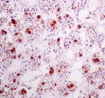 Immunohistochemistry (Formalin/PFA-fixed paraffin-embedded sections) - Anti-Luteinizing Hormone beta antibody [EPR8195] - BSA and Azide free (AB221494)