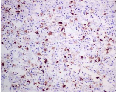 Immunohistochemistry (Formalin/PFA-fixed paraffin-embedded sections) - Anti-Luteinizing Hormone beta antibody [EPR8196] (AB150416)