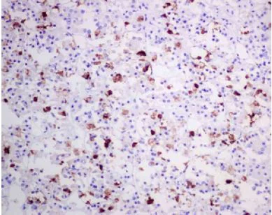 Immunohistochemistry (Formalin/PFA-fixed paraffin-embedded sections) - Anti-Luteinizing Hormone beta antibody [EPR8196] - BSA and Azide free (AB221493)
