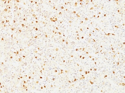 Immunohistochemistry (Formalin/PFA-fixed paraffin-embedded sections) - Anti-Luteinizing Hormone beta antibody [LHb/1214] - BSA and Azide free (AB212577)