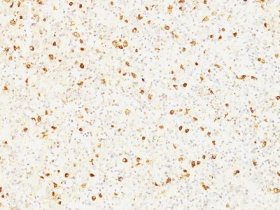 Immunohistochemistry (Formalin/PFA-fixed paraffin-embedded sections) - Anti-Luteinizing Hormone beta antibody [LHb/1214] - BSA and Azide free (AB212577)