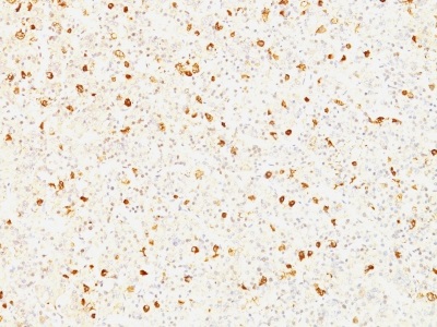 Immunohistochemistry (Formalin/PFA-fixed paraffin-embedded sections) - Anti-Luteinizing Hormone beta antibody [SPM103] (AB233918), expandable thumbnail