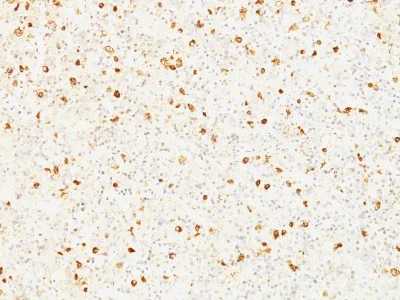 Immunohistochemistry (Formalin/PFA-fixed paraffin-embedded sections) - Anti-Luteinizing Hormone beta antibody [SPM103] (AB233918)