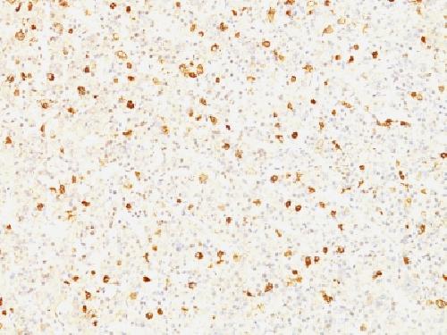 Immunohistochemistry (Formalin/PFA-fixed paraffin-embedded sections) - Anti-Luteinizing Hormone beta antibody [SPM103] - BSA and Azide free (AB212578)