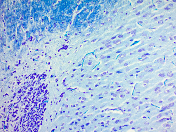 Immunohistochemistry (Formalin/PFA-fixed paraffin-embedded sections) - Luxol Fast Blue Stain Kit (Myelin Stain) (AB150675), expandable thumbnail
