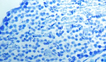 Immunohistochemistry (Formalin/PFA-fixed paraffin-embedded sections) - Luxol Fast Blue Stain Kit (Myelin Stain) (AB150675)