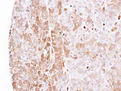 Immunohistochemistry (Formalin/PFA-fixed paraffin-embedded sections) - Anti-LXN/TCI antibody (AB154744)
