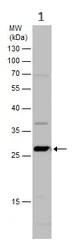 Western blot - Anti-LXN/TCI antibody (AB154744)