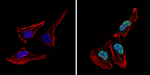 Immunocytochemistry - Anti-LXR alpha antibody (AB3585)