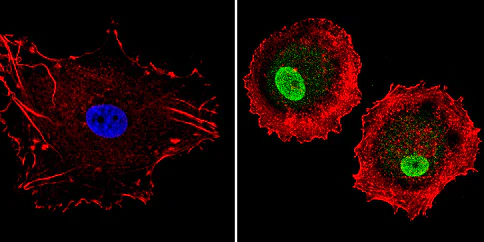 Immunocytochemistry - Anti-LXR alpha antibody (AB3585)