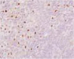Immunohistochemistry (Formalin/PFA-fixed paraffin-embedded sections) - Anti-LXR alpha antibody [PPZ0412] (AB41902)